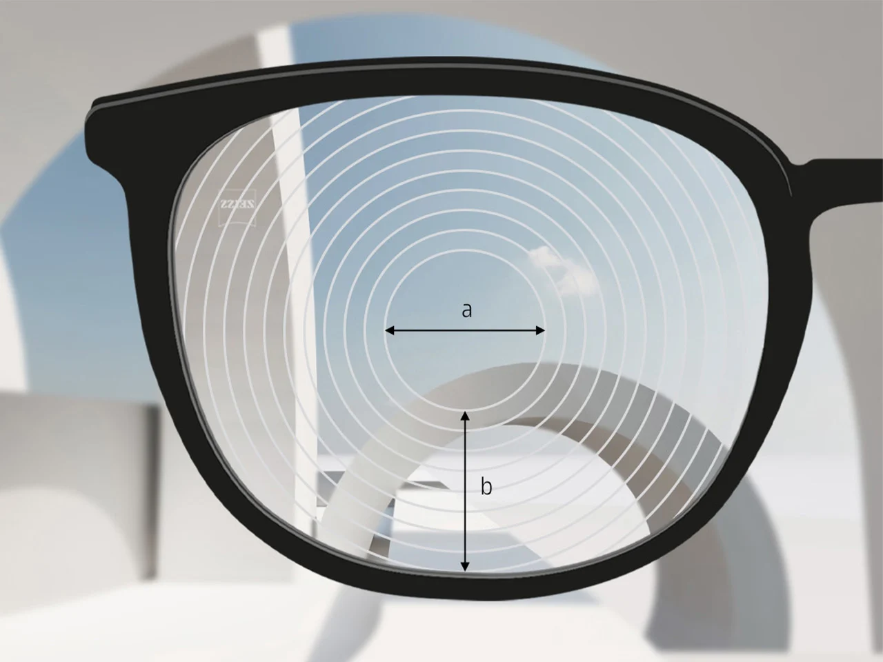 Dettaglio ZEISS ZEISS MyoCare